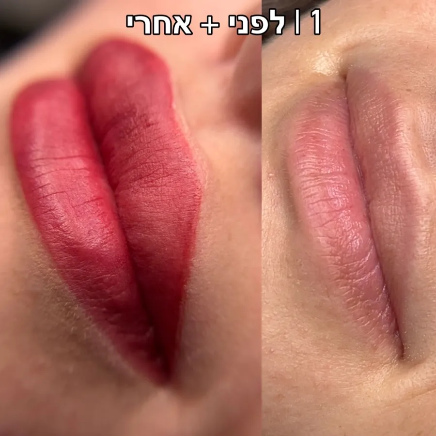 שלב 1: לפני ומיד אחרי הטיפול
